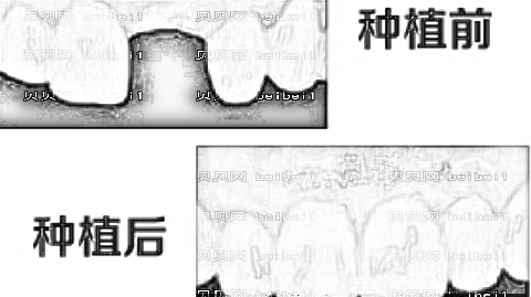 上海新浦口腔医院怎么样?医生介绍名单