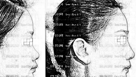 深圳千羽整形医院靠谱吗?,整形一览表!哪个医生技术好?
