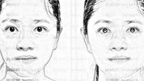 益阳南湖整形口碑怎么样?益阳南湖祛眼袋多少钱?附医生介绍