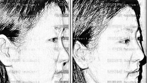 苏州隆鼻哪家医院好?公布苏州隆鼻医生排名前五榜单|附介绍