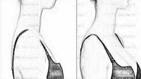 厦门丰胸哪个医生技术好?公布厦门隆胸医生前五榜单,附