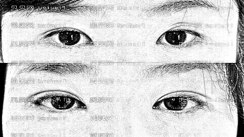 广州双眼皮哪个医生技术好?广州车亮亮双眼皮做得怎么样?