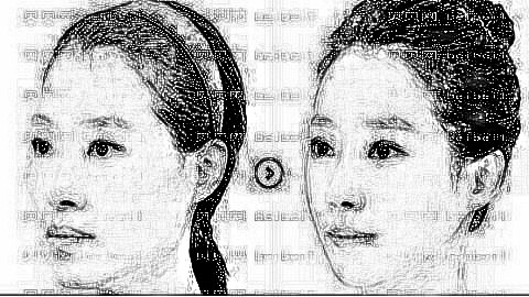 揭秘厦门脂肪填充排名前五医生名单|附医生介绍+介绍分享