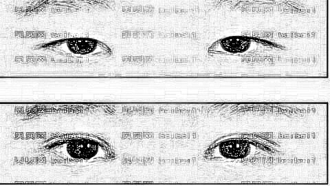 南昌哪个医生做双眼皮口碑好?南昌好做眼睛怎么样?贵吗?