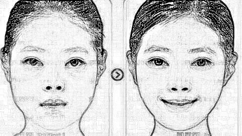 郑州割双眼皮哪个医生靠谱?郑州李虎星双眼皮做得好不好?