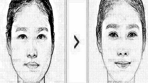 深圳割双眼皮哪个医生靠谱?深圳金顺女做眼睛怎么样?贵吗?