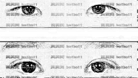 阜阳哪个医生做双眼皮厉害?阜阳李进超双眼皮做得好不好?