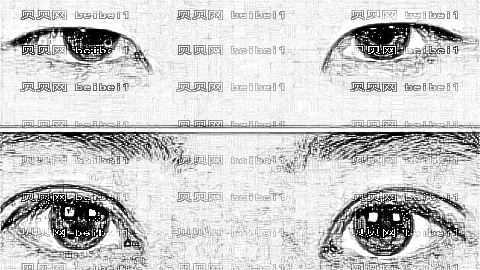 佛山哪个医生做双眼皮厉害?佛山孙文娜双眼皮做得怎么样?