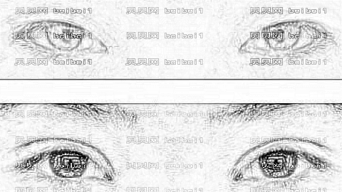 上海哪个医生做双眼皮厉害?上海刘春双眼皮做得怎么样?