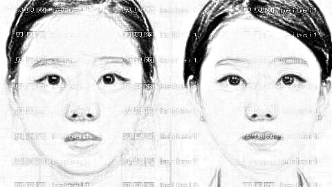 西安卫国强医生做下颌角整形技术怎么样？附医生介绍+介绍