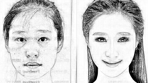 罗恩做下颌角整形怎么样?成都友谊医院罗恩磨骨价格多少钱?