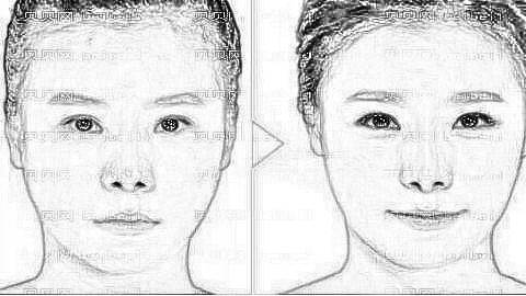 深圳华侨医院籍如恭下颌角磨骨技术好不好？籍如恭口碑好吗？