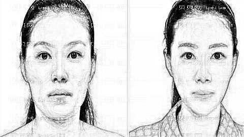 沈阳杏林朱石江做下颌角整形手术靠谱吗?附医生介绍+磨骨介绍