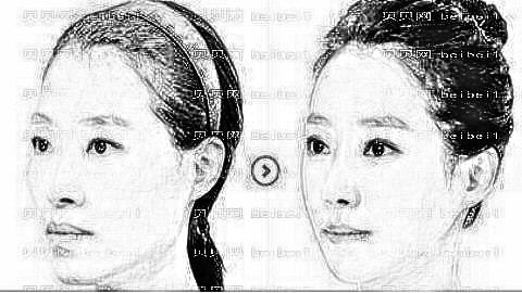 上海下颌角整形哪家医院做得好?上海做磨骨多少钱?附介绍