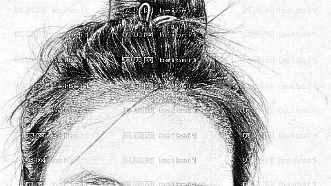 绍兴植发哪家医院好?多少钱?附绍兴植发医生排名名单