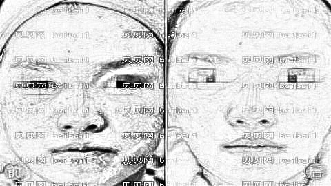 沈阳祛斑哪家医院好?沈阳激光祛斑多少钱?附祛斑介绍