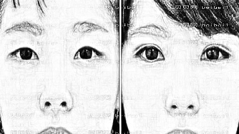 衡阳美莱医疗美容医院双眼皮做得怎么样？大概多少钱？