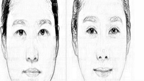 呼和浩特双眼皮哪个医生靠谱?呼和浩特王艳波做眼睛收费高吗?