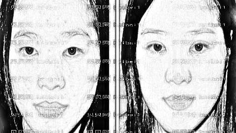 秦皇岛双眼皮哪个医生技术好?秦皇岛咸福实双眼皮做得怎么样?
