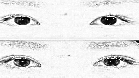 哈尔滨割双眼皮哪个医生靠谱?哈尔滨赵世华做眼睛价格贵吗?
