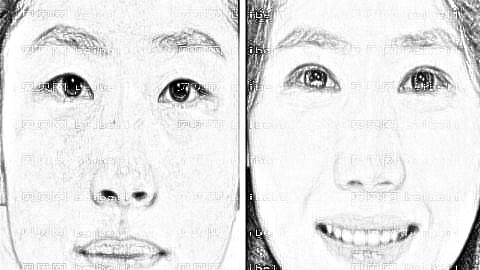亳州缔莱美医疗美容做眼袋怎么样?亳州缔莱美去眼袋多少钱?
