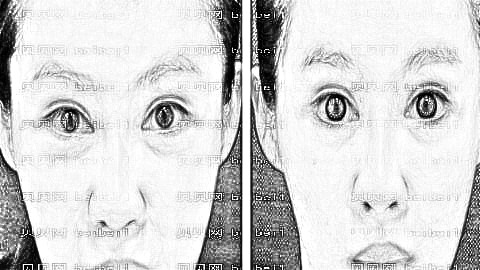 成都米兰柏羽做眼袋果怎么样?成都米兰柏羽去眼袋多少钱?