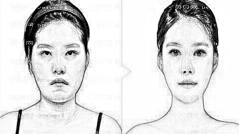 苏州下颌角整形哪家医院做得好?苏州做磨骨多少钱?附介绍