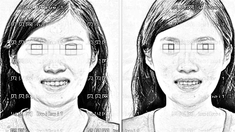 重庆爱思特袁伟磨骨技术好不好?袁伟下颌角整形多少钱?