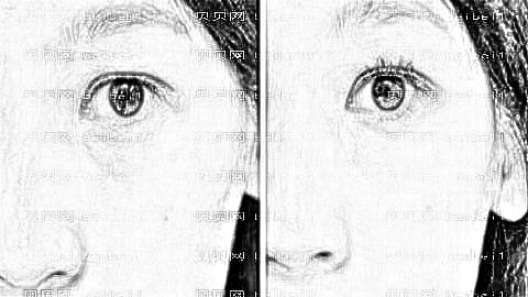 深圳东芳韵美做眼袋果怎么样?深圳东芳韵美去眼袋多少钱?