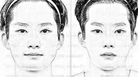 郑州磨骨大咖赵绛波医生怎么样?赵绛波下颌角整形多少钱?