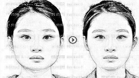 上海颌面整形医生刘先超怎么样?刘先超下颌角整形靠谱吗?