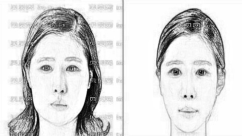 薇琳穆雄铮做下颌骨磨骨果好吗?穆雄铮颧骨手术技术好吗?