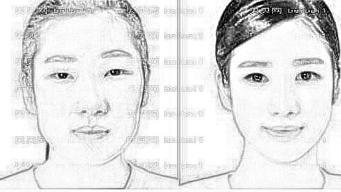 广州何锦泉医生做正颌怎么样?何锦泉凸嘴矫正多少钱?