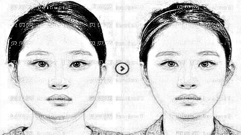 武汉中翰吴中兴下颌角整形技术好吗?吴中兴磨骨价格高吗?