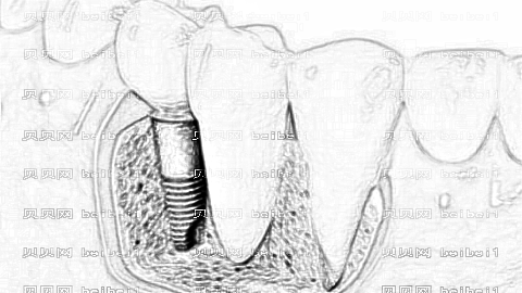 苏大附二院种牙医生技术好不好?医生名单+全新