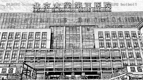 北医三院割双眼皮怎么样?好吗?