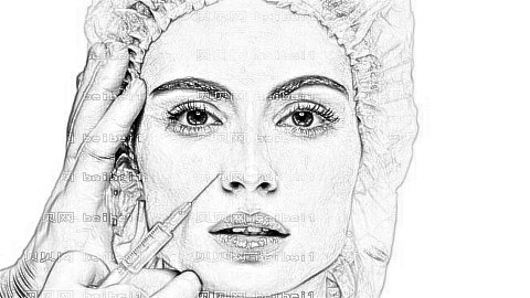 西安何犇隆鼻技术怎么样?何犇医生隆鼻多少钱?附野生介绍