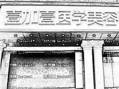 佛山壹加壹整形隆胸做得好不好？佛山壹加壹9月隆胸上线
