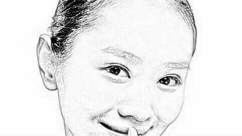 成都成美吸脂怎么样?成都成美吸脂介绍,脸部轮廓明X!