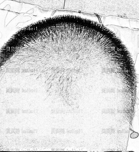 兰大二院植发哪个医生好?医生名单+,全新价位表