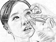 南京鼓楼医院郑东风医生怎么样？郑东风去眼袋做得好不好？