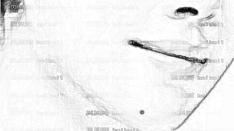 北医三院薛红宇和王侠磨骨谁做的好?技术怎么样?
