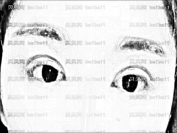 内蒙古包钢医院路玮做眼睛靠谱吗?路玮割双眼皮9月
