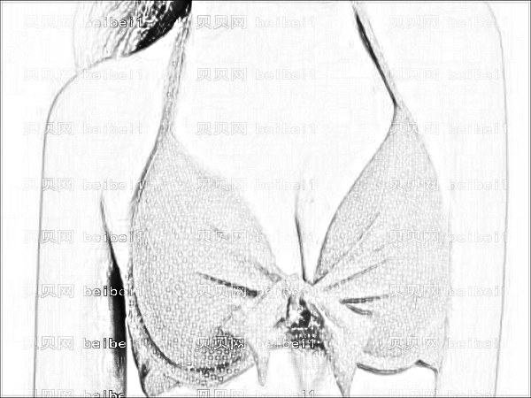 苏州邢汉银怎么样？邢汉银做隆胸果好不好？价格贵吗？