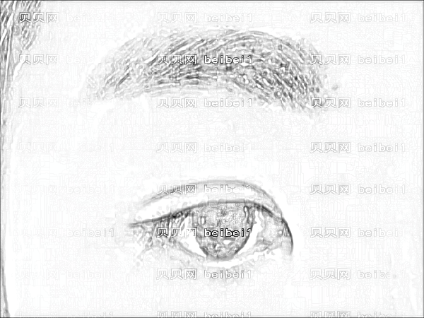 北大深圳医院做眼睛好看吗?庄礼大做双眼皮技术好吗?