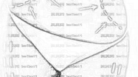 北京贵美汇吸脂怎么样?北京贵美汇吸脂介绍,术后变美了!