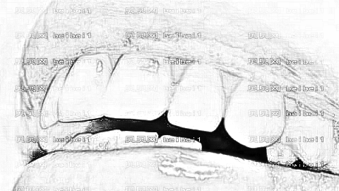 大医一院种牙好吗?,口腔种植牙介绍及收费