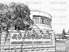 上海武警总院隆胸怎么样？周志钢医生隆胸技术好不好？