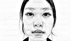 山东省立医院王法刚医生双眼皮做得怎么样？口碑反馈好不好？