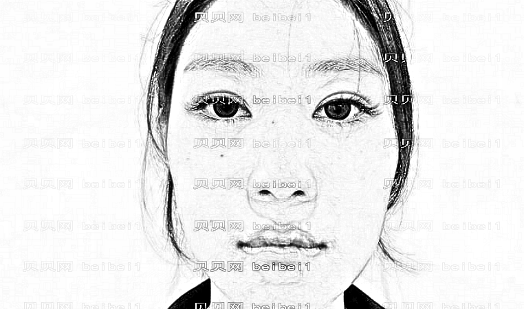 山东省立医院王法刚医生双眼皮做得怎么样？口碑反馈好不好？